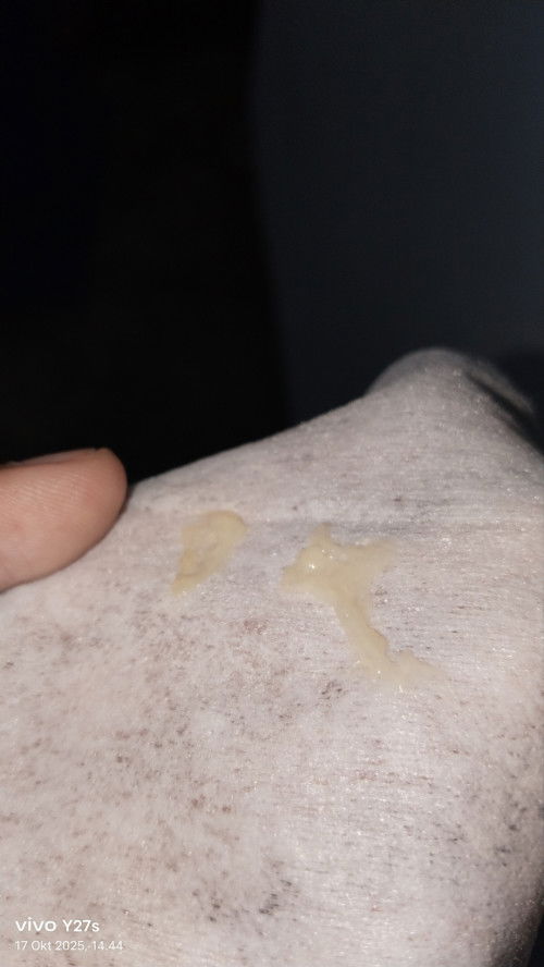 Nifas: lendir warna putih