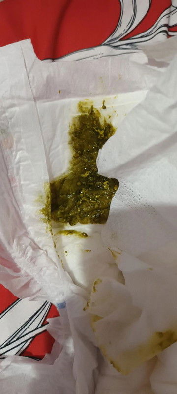 BAB warna hijau sudah 5 hari, full asi kenapa yaa bund