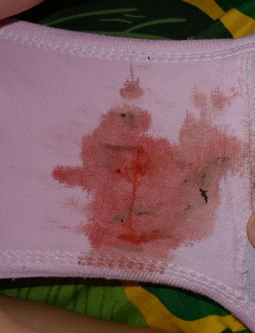Bun tadi pagi gada lgi fleknya tbtb bgt bangun tdr siang begini ,saya hamil 12 week perut kram