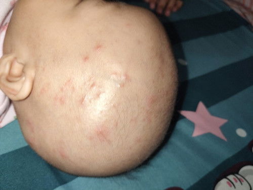 Kepala bayi merah-merah