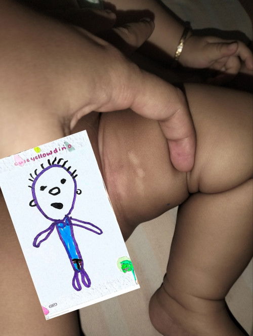 Masalah Kulit Bayi