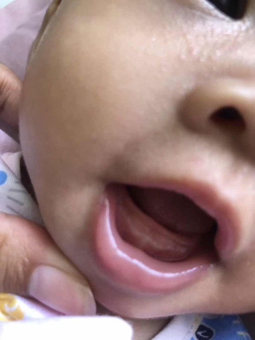 ฟันจะขึ้นใช่ไหมคะแม่ๆ