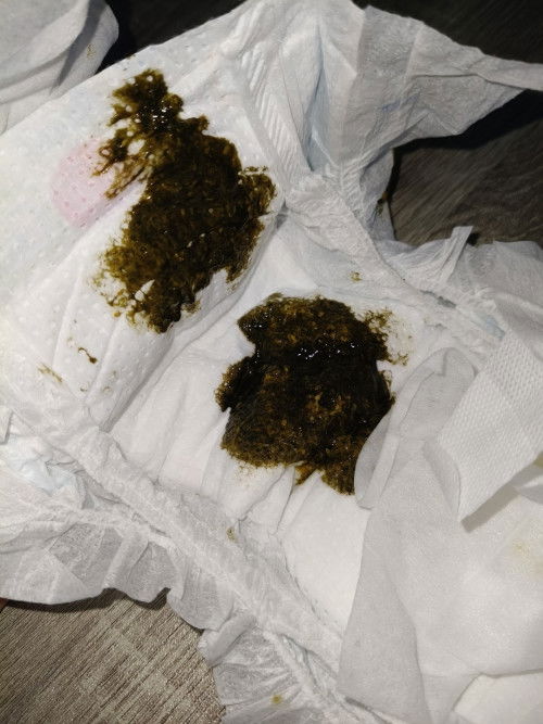 น้องถ่ายแบบนี้ปกติรึเปล่าคะ