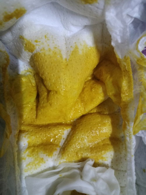 อึแบบนี้ปกติไหมค่ะ