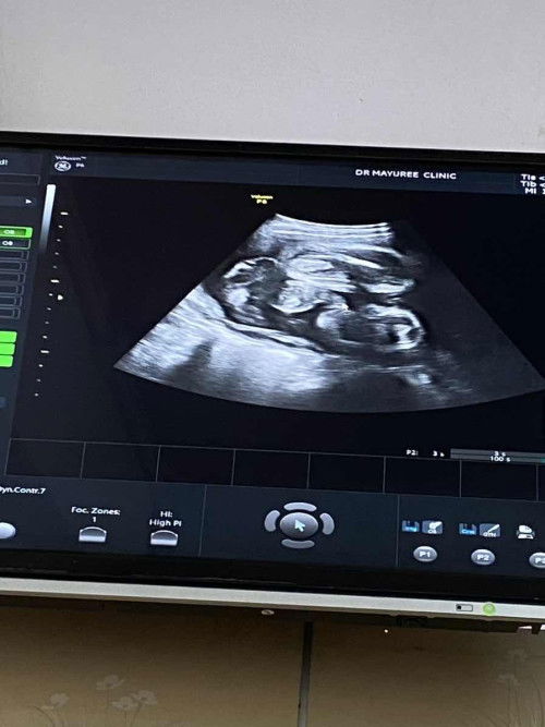 แม่ๆช่วยดูหน่อยค่ะเพศไหน