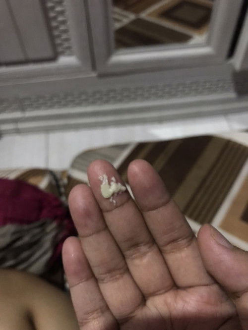 Bun ada yang sama kaya aku hamil TM2 keputihan