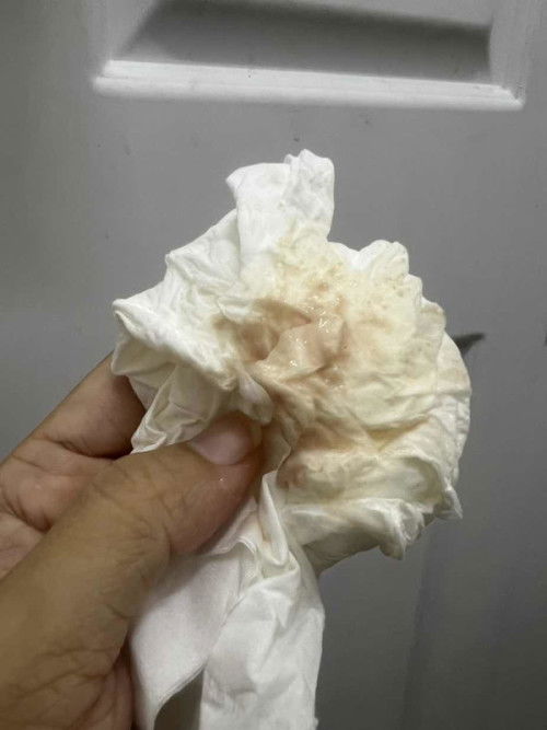 ท้อง16week มีตกขาวสีออกน้ำตาลอ่อนแบบนี้เป็นอะไรไหมค่ะ