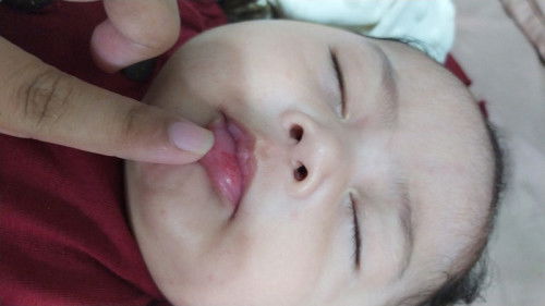 Bibir dalam bayi merah