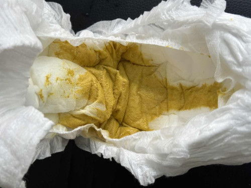 น้องอายุ9เดือน อึแบบนี้คือปกติมั้ยคะ