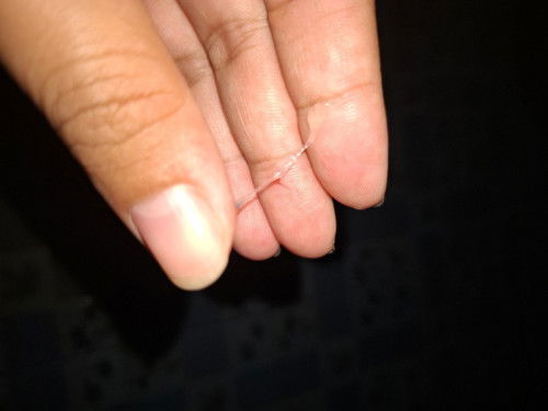 สอบถามแม่หน่อยคะท้อง27+3