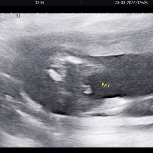 น้องมีโอกาสจะเป็นผู้หญิงบ้างมั้ยคะ🤣