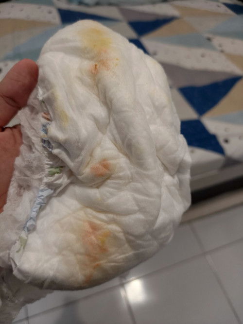 Mau tanya bunda2. Apa ada babynya yg pernah seperti ini ya pipisnya? Baby ku ini skrg umur 6bln pere