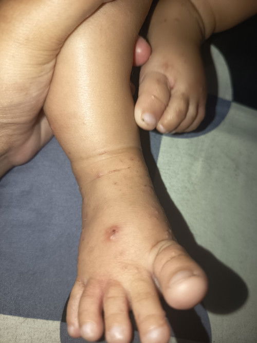 Info salep buat kuman air