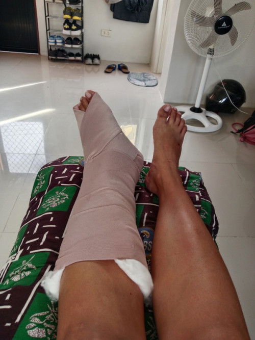 30 Weeks- With Ankle Injury
What exercises can you recommend for a safe and faster delivery?