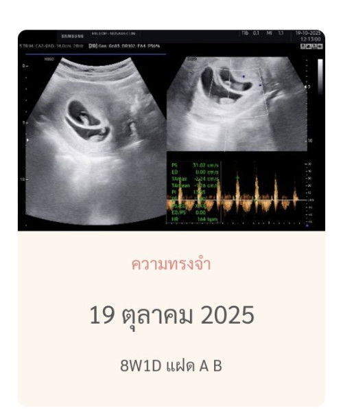 น้องเท่ากันแล้วนะคะ