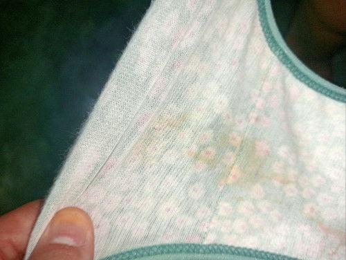 Ni lendir berdarah ke