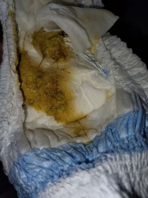 ท้องเสียหลายครั้ง