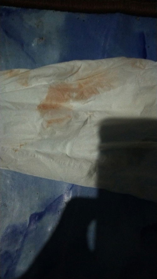 Hamil jalan 14 Minggu