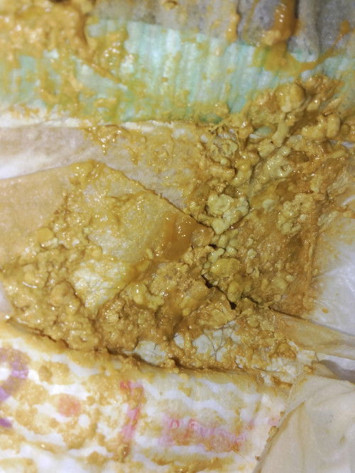 แบบนี้ปกติมั้ยคะ