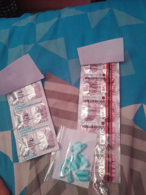 Keputihan di 14 weeks