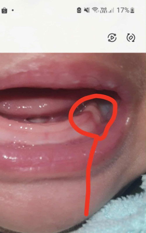 อยากสอบถามหน่อยค่ะน้อง3เดือน26วัน