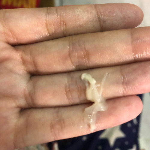 อันนี้คือมูกมั้ยคะ