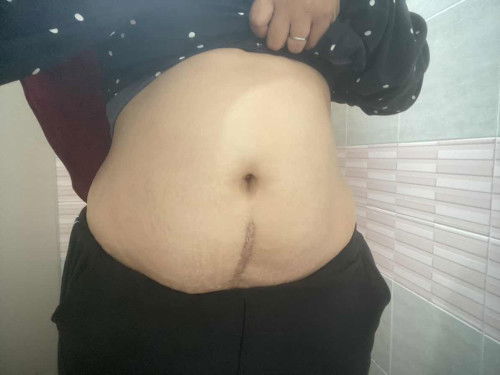 ขอถามแม่ๆหน่อยค่ะ