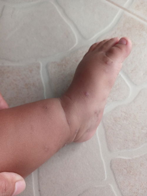 Baby bath reco for 1yr old with sensitive skin aside from Cetaphil