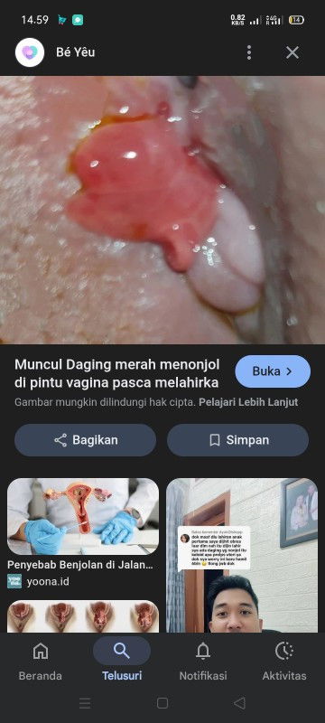 tentang jahitaan