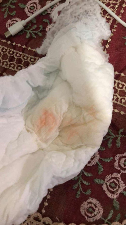 bayi kencing kuning/merah