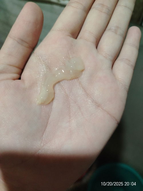 Mucus plug malapit naba