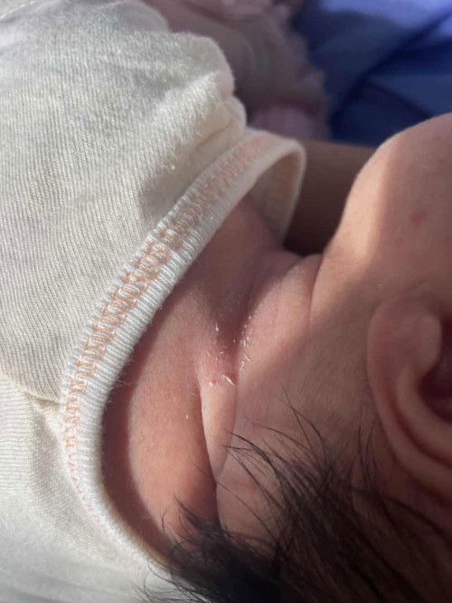 ที่คอคืออะไรคะ