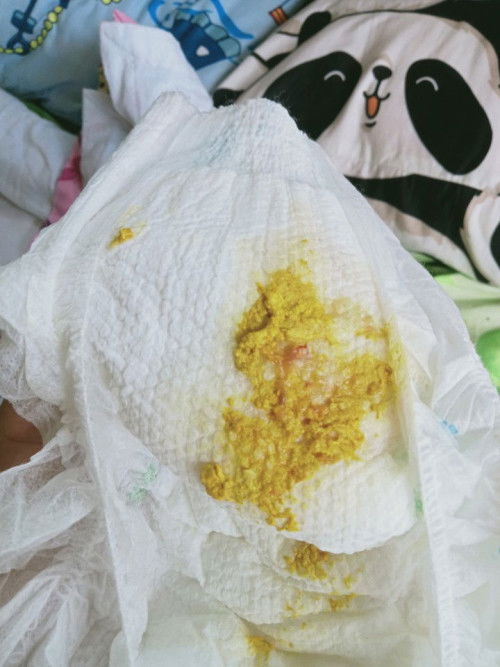 Normal lng po ba sa sa newborn Yung po na parang may jelly na may kaunting dugo?