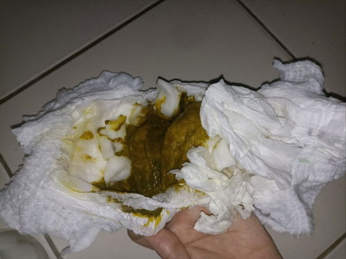 Pup bayi usia 4 bulan, hi bun ini anakku pupnya begini apakah masih normal ? Aku newmom
