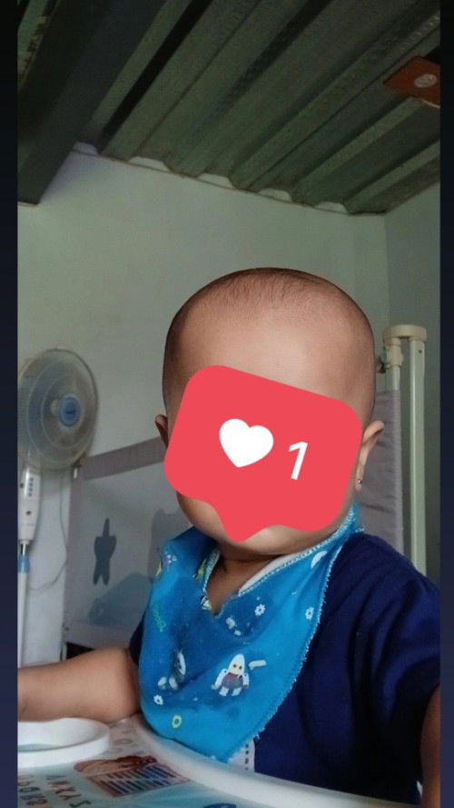 Mempercepat pertumbuhan rambut