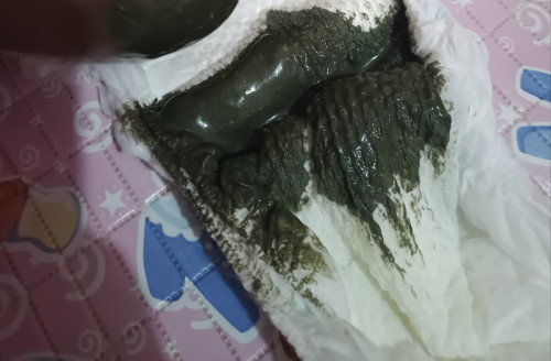 Warna BAB bayi 4 bulan