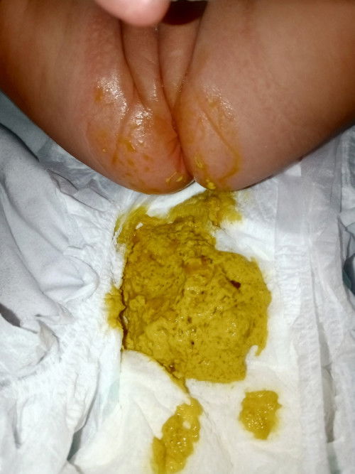 Yellow poop with brown mucus