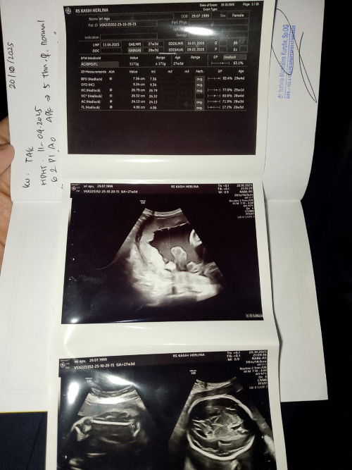 kira" ini pakai berapa dimensi y d monitor orens tpi d cetak hitam putih