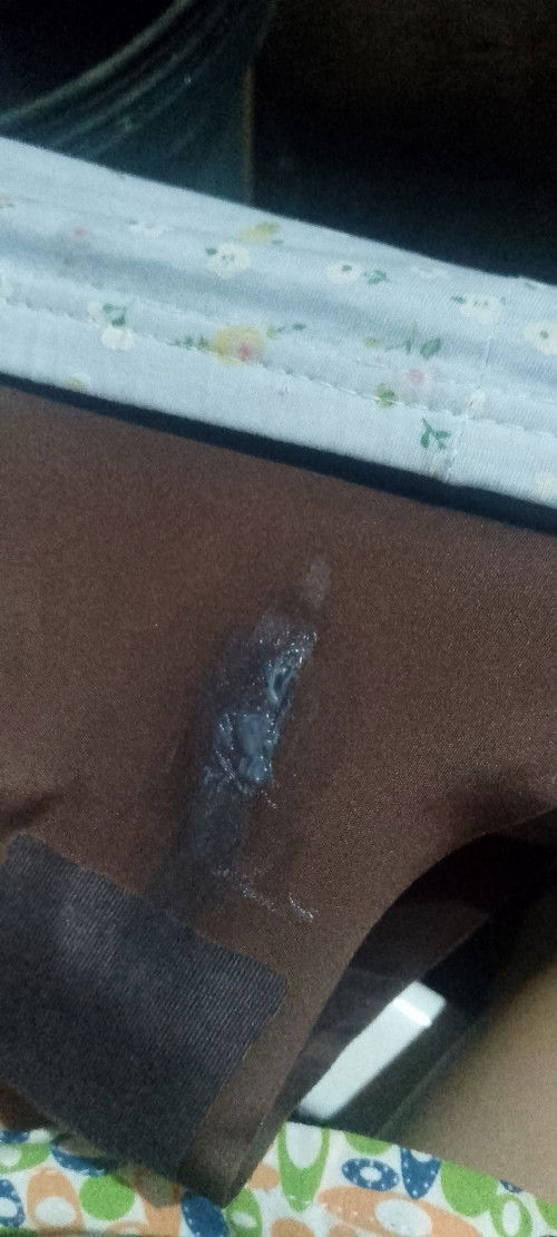 Discharge. Do I need to see my OB?