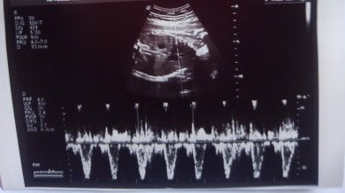 Hi can i ask if what is this image in my baby parts of body?