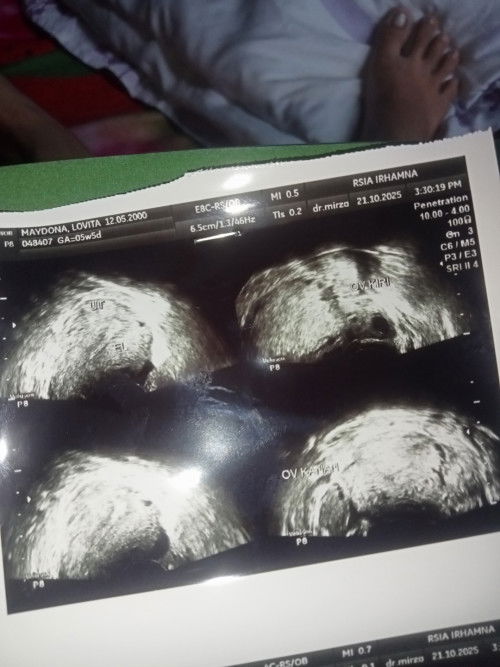 Ada yang bisa baca hasil usg tidak bund