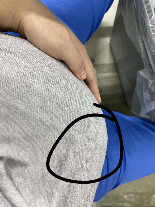 Normal lang po ba sumakit eto 33weeks and 6days napo ako sana po mapansin?