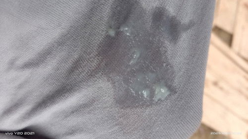 Keputihan saat hamil