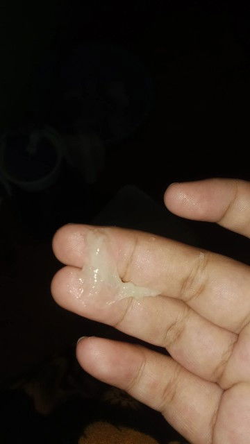 Kluar lendir persalinan