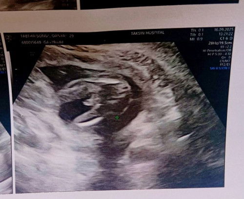 631กรัม23วีคน้องโตไปไหมคะ