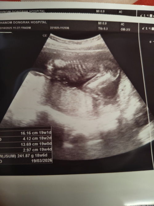 น้องอยู่ในท่าไหนคะแม่ๆ 
หัวกับแขนน้องอยู่ตรงไหน