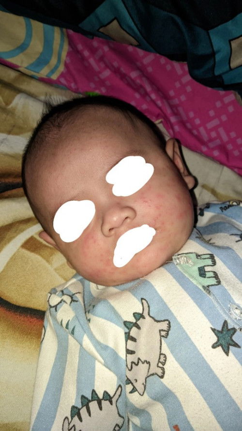 muncul bintik merah2