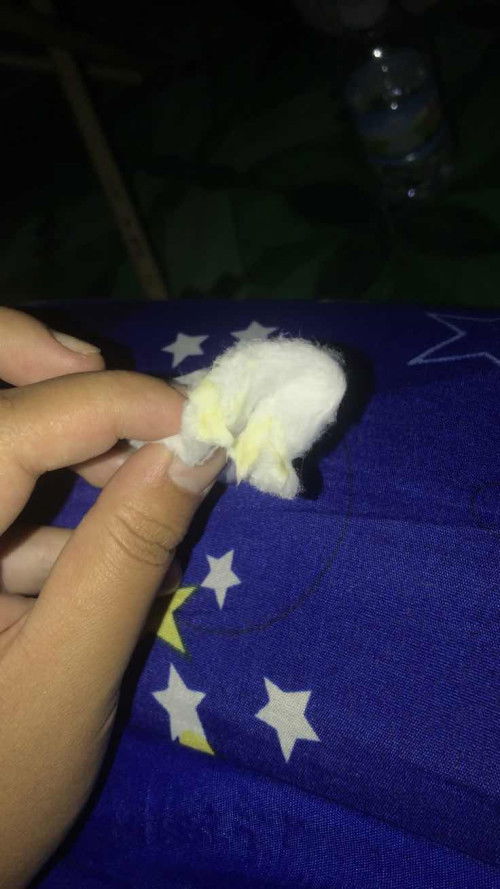 แม่ๆบ้านไหนเป็นบ้างมั้ยคะ