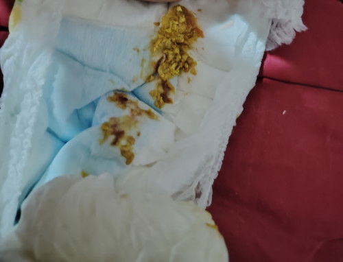 pertanyaan anak cirit berdrh