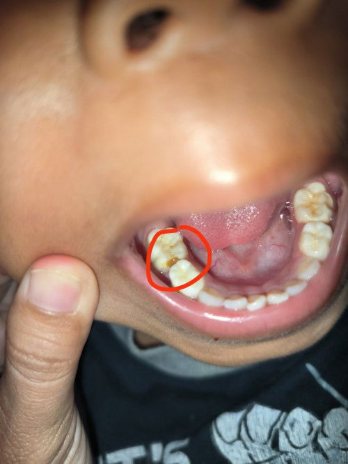 Apa perlu ke dokter gigi?